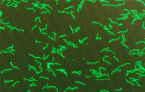Dedimed Borreliose-Test Diagnostik Berlin